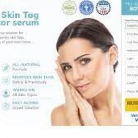 How to remove an unwanted mole